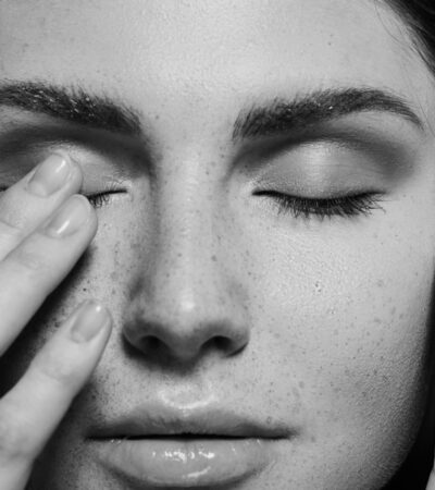 Cortisol Face - 6 Things Your Skin Does When You're Too Stressed